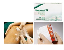 MEDICAZIONE STERILE IN FILM IN POLIURETANO TRASP. SUPRASORB F 10X12CM 10 PEZZI - Magnumfarma.it